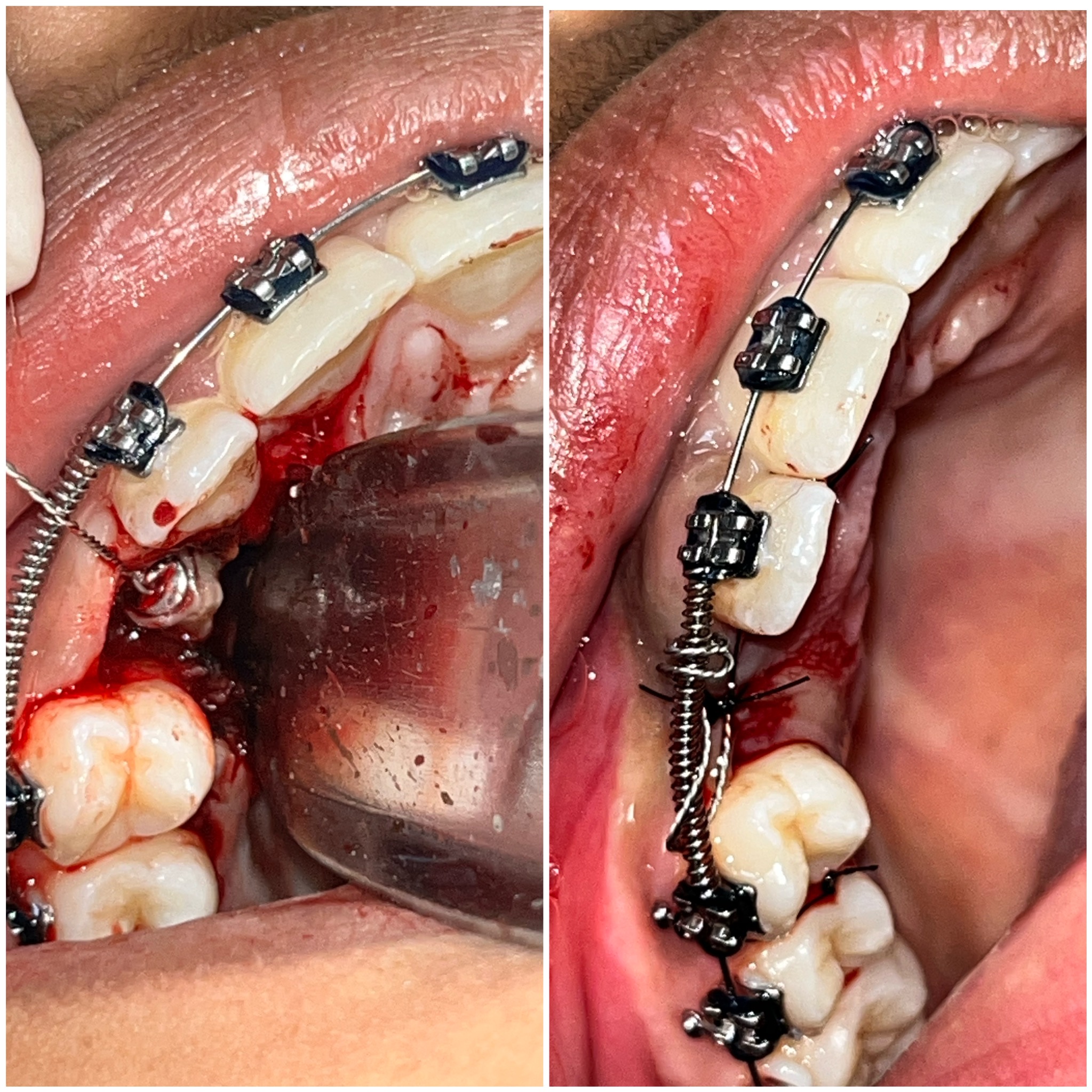 9257F5C5-6ABA-46C0-A950-BDB5C4D9ED35-73648-00000CCB303E3938